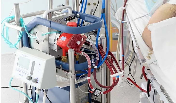 ଭୁବନେଶ୍ୱର ଏମ୍ସକୁ ଆସିଲା  ପ୍ରଥମ ECMO ମେସିନ୍