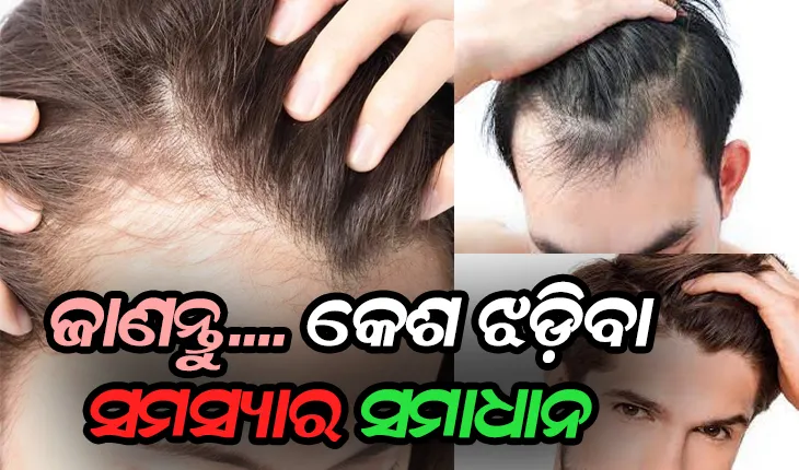 କେଶ ଝଡ଼ିବାରୁ କପରି ପାଇବେ ମୁକ୍ତି: ଜାଣନ୍ତୁ ହୋମିଓପାଥି, ଏଲୋପାଥି ଓ ଆୟୁର୍ବେଦ ଓପଚାର