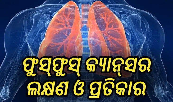 ଜାଣନ୍ତୁ ଫୁସ୍‌ଫୁସ୍ କ୍ୟାନ୍‌ସର କ’ଣ , ଏହାର ଲକ୍ଷଣ ଓ ପ୍ରତିକାର