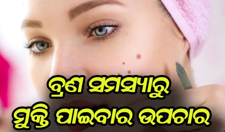 ବ୍ରଣ ସମସ୍ୟାରୁ ମୁକ୍ତି ପାଇବା ପାଇଁ ଜାଣନ୍ତୁ ଉପଚାର