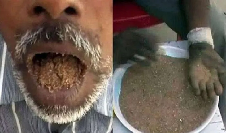 ମାଟି ଖାଇ ବଞ୍ଚିଛନ୍ତି ୨୫ ବର୍ଷ