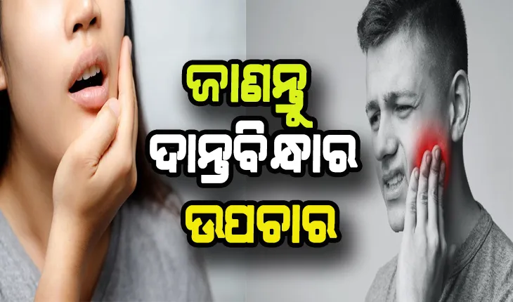 ଦାନ୍ତବିନ୍ଧା ସମସ୍ଯାରୁ ମୁକ୍ତି ପାଇବା ପାଇଁ ଜାଣନ୍ତୁ ଉପଚାର
