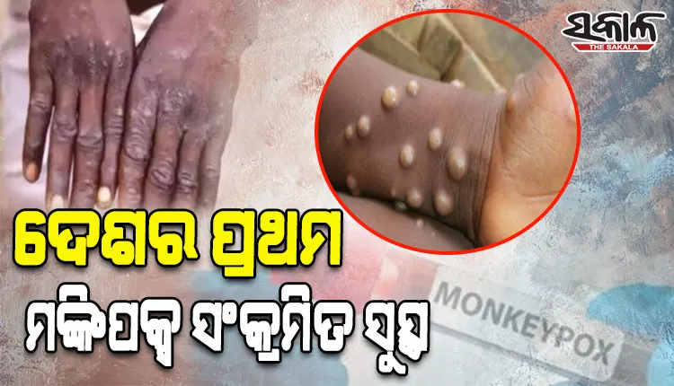 ସୁସ୍ଥହେଲେ ଭାରତର ପ୍ରଥମ ମଙ୍କିପକ୍ସ ଆକ୍ରାନ୍ତ ବ୍ୟକ୍ତି