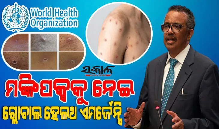 ଚିନ୍ତାଜନକ ସ୍ଥିତିରେ ମଙ୍କିପକ୍ସ ସଂକ୍ରମଣ : ଅନ୍ତର୍ଜାତୀୟ ଜରୁରୀକାଳୀନ ସ୍ୱାସ୍ଥ୍ୟ ସଙ୍କଟ ଘୋଷଣା କଲା ‘ହୁ’