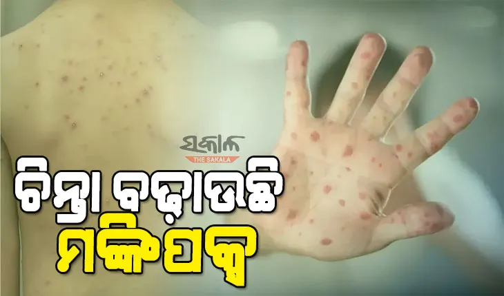 ପୁଣି କେରଳରୁ ଚିହ୍ନଟ ହେଲେ ଆଉ ଜଣେ ମଙ୍କିପକ୍ସ ଆକ୍ରାନ୍ତ