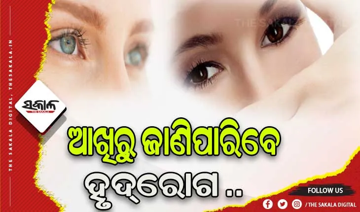 ଆଖିରୁ ଜାଣିହେବ ହୃଦ୍‌ରୋଗର ପ୍ରାଥମିକ ଲକ୍ଷଣ….