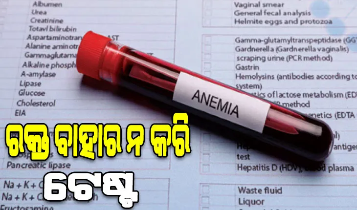 ସ୍ମାର୍ଟଫୋନ୍‌ରୁ ଜଣାପଡ଼ିବ ହିମୋଗ୍ଲୋବିନ୍‌ ସ୍ତର