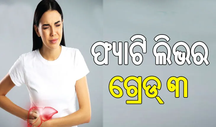 ଫ୍ୟାଟି ଲିଭର ଗ୍ରେଡ୍‌ ୩ କ’ଣ.., ଜାଣନ୍ତୁ ଏହା କେତେ ବିପଦ ଜନକ…