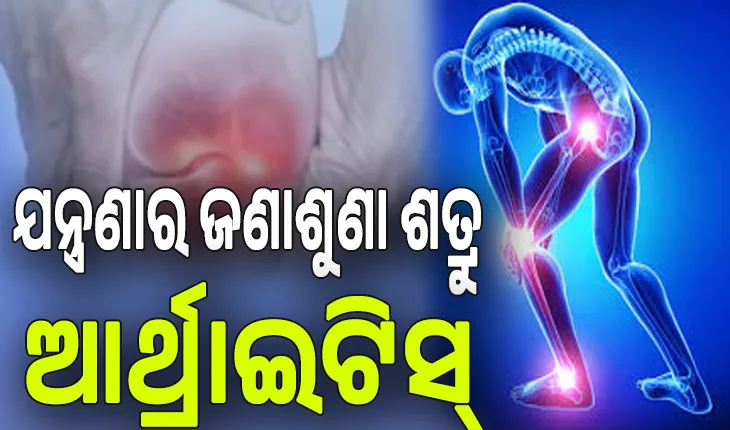 ଯନ୍ତ୍ରଣାର ଜଣାଶୁଣା ଶତ୍ରୁ ଆର୍ଥ୍ରାଇଟିସ୍‌; ଜାଣନ୍ତୁ ଏହାର କାରଣ, ଲକ୍ଷଣ, ପ୍ରଭାବ ଓ ନିରାକରଣ