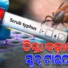 ସୁନ୍ଦରଗଡ଼ରେ ସ୍କ୍ରବ୍ ଟାଇଫସ୍ ଚିନ୍ତା: ଆକ୍ରାନ୍ତଙ୍କ ସଂଖ୍ୟା ୮୦୦ ପାର୍, ସ୍ଥିତି ଉପରେ ସ୍ୱାସ୍ଥ୍ୟ ବିଭାଗର ନଜର