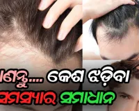 କେଶ ଝଡ଼ିବାରୁ କପରି ପାଇବେ ମୁକ୍ତି: ଜାଣନ୍ତୁ ହୋମିଓପାଥି, ଏଲୋପାଥି ଓ ଆୟୁର୍ବେଦ ଓପଚାର