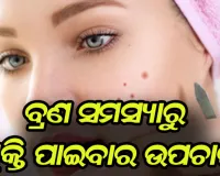 ବ୍ରଣ ସମସ୍ୟାରୁ ମୁକ୍ତି ପାଇବା ପାଇଁ ଜାଣନ୍ତୁ ଉପଚାର