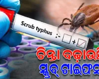 ସୁନ୍ଦରଗଡ଼ରେ ସ୍କ୍ରବ୍ ଟାଇଫସ୍ ଚିନ୍ତା: ଆକ୍ରାନ୍ତଙ୍କ ସଂଖ୍ୟା ୮୦୦ ପାର୍, ସ୍ଥିତି ଉପରେ ସ୍ୱାସ୍ଥ୍ୟ ବିଭାଗର ନଜର
