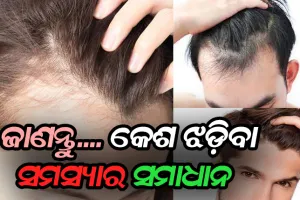 କେଶ ଝଡ଼ିବାରୁ କପରି ପାଇବେ ମୁକ୍ତି: ଜାଣନ୍ତୁ ହୋମିଓପାଥି, ଏଲୋପାଥି ଓ ଆୟୁର୍ବେଦ ଓପଚାର