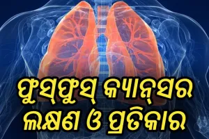 ଜାଣନ୍ତୁ ଫୁସ୍‌ଫୁସ୍ କ୍ୟାନ୍‌ସର କ’ଣ , ଏହାର ଲକ୍ଷଣ ଓ ପ୍ରତିକାର