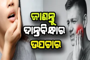 ଦାନ୍ତବିନ୍ଧା ସମସ୍ଯାରୁ ମୁକ୍ତି ପାଇବା ପାଇଁ ଜାଣନ୍ତୁ ଉପଚାର