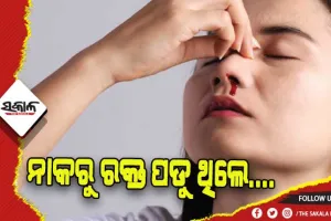 ନାକରୁ ରକ୍ତ ପଡିବା ସମସ୍ୟା ଦୂର କରିବା ପାଇଁ ଜାଣନ୍ତୁ ଉପଚାର