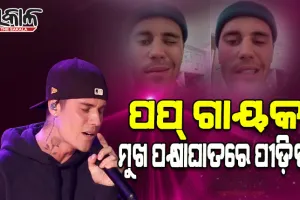 ଜଷ୍ଟିନ୍ ବିବରଙ୍କ ଫ୍ୟାନଙ୍କୁ ବଡ଼ ଝଟକା: ମୁଖ ପକ୍ଷାଘାତ ରୋଗରେ ଆକ୍ରାନ୍ତ ହେଲେ ପପ୍ ଗାୟକ ଜଷ୍ଟିନ ବିବର୍