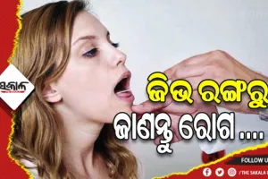 ଜାଣନ୍ତୁ କେଉଁ ରଙ୍ଗର ଜିଭ କେଉଁ ରୋଗ ସମ୍ପର୍କରେ ସୂଚନା ଦିଏ….