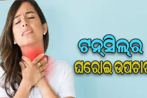 ଜାଣନ୍ତୁ କିପରି କରିବେ ଟନ୍‌ସିଲ୍‌ ସମସ୍ୟାର ଘରୋଇ ଉପଚାର