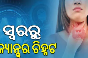 କର୍କଟ ଚିହ୍ନଟ ପାଇଁ ନୂଆ ବିକଳ୍ପ; ସ୍ବର ପରିବର୍ତ୍ତନରୁ ଜାଣିହେବ ଗଳା କର୍କଟ ହେବାର ଆଶଙ୍କା…