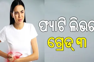 ଫ୍ୟାଟି ଲିଭର ଗ୍ରେଡ୍‌ ୩ କ’ଣ.., ଜାଣନ୍ତୁ ଏହା କେତେ ବିପଦ ଜନକ…