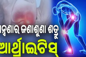 ଯନ୍ତ୍ରଣାର ଜଣାଶୁଣା ଶତ୍ରୁ ଆର୍ଥ୍ରାଇଟିସ୍‌; ଜାଣନ୍ତୁ ଏହାର କାରଣ, ଲକ୍ଷଣ, ପ୍ରଭାବ ଓ ନିରାକରଣ