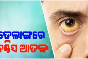ଡେଲାଙ୍ଗରେ ଜଣ୍ଡିସ ଆତଙ୍କ: ୧୭ରୁ ଅଧିକ ପିଲା ଆକ୍ରାନ୍ତ, ଘଣ୍ଟ ଓ ମାଇକ୍‌ ମାଧ୍ୟମରେ ଗାଁ ଗାଁ ବୁଲି ସଚେତନ କରୁଛନ୍ତି ଆଶାକର୍ମୀ