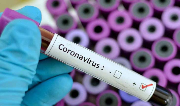 ରାଜ୍ୟରୁ ଆଜି ଚିହ୍ନଟ ହେଲେ ଆଉ ୧୧, ୦୯୯ କରୋନା ଆକ୍ରାନ୍ତ