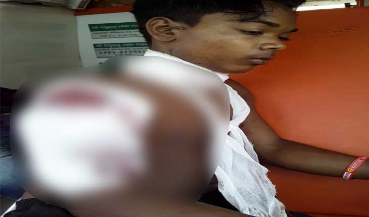 ଜଙ୍ଗଲକୁ ଛେଳି ଚରାଇବା ପାଇଁ ଯାଇଥିବା ବେଳେ ଶିକାରୀ ଗୁଳି ବାଜି ନାବାଳକ ଗୁରୁତର