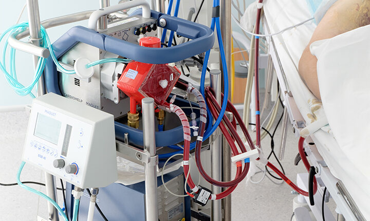 ଖୁବଶୀଘ୍ର ଭୁବନେଶ୍ୱର ଏମ୍ସରେ ସ୍ଥାପନ ହେବ ଦୁଇଟି ECMO ମେସିନ