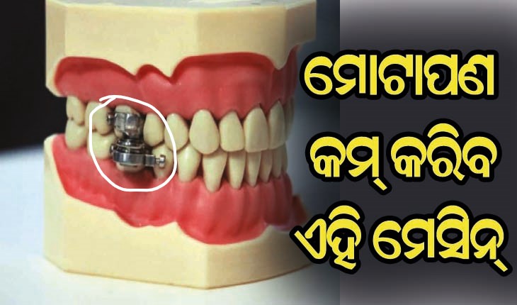 ମୋଟାପଣ କମ୍ କରିବ ମେସିନ୍