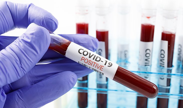 ରାଜ୍ଯରେ ଆଜି ଚିହ୍ନଟ ହେଲେ ଆଉ ୩୭୪ ନୂଆ ଆକ୍ରାନ୍ତ, ୦-୧୮ ବର୍ଷ ବୟସ ୬୫ ପଜିଟିଭ୍