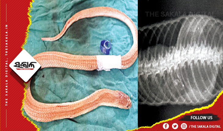 ଓୟୁଏଟିରେ ଦୀର୍ଘ ଦେଢ଼ ଘଣ୍ଟାର ଅପରେସନ ପରେ ତମ୍ପ ପେଟରୁ ବାହାରିଲା ବୋତଲ ଠିପି