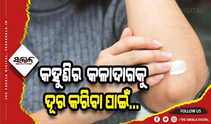 ଜାଣନ୍ତୁ କିପରି ଲିଭିବ କହୁଣି କଳା ଦାଗ….