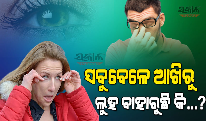 ସବୁବେଳେ ଆଖିରୁ ଲୁହ ବାହାରୁଥିଲେ କଣ କରିବେ ଜାଣନ୍ତୁ….