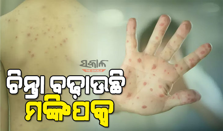 ୨୦ ଦିନରେ ୨୭ ଦେଶକୁ ବ୍ୟାପିଲା ମଙ୍କିପକ୍ସ : ୭୮୦ ଲୋକ ସଂକ୍ରମିତ, ଭୂତାଣୁ ନେଲାଣି ୧୦ ଜୀବନ