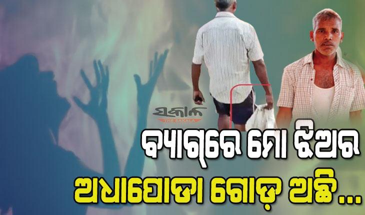 ଝିଅର ଅଧା ପୋଡା ଗୋଡ ଧରି ଥାନାରେ ବସିଛି ବାପା : ଯୌତୁକ ଦେଇ ପାରିଲିନି ବୋଲି ଶାଶୁଘର ଲୋକ ପୋଡିଦେଲେ, ମୋତେ ନ୍ୟାୟ ଦରକାର…