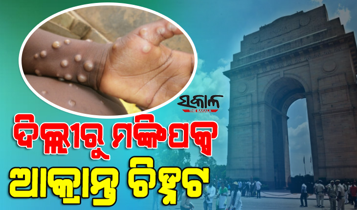 ଦେଶରେ ବ୍ୟାପୁଛି ମଙ୍କିପକ୍ସ : କେରଳ ପରେ ରାଜଧାନୀ ଦିଲ୍ଲୀରୁ ଚିହ୍ନଟ ହେଲା ଚତୁର୍ଥ ମାମଲା