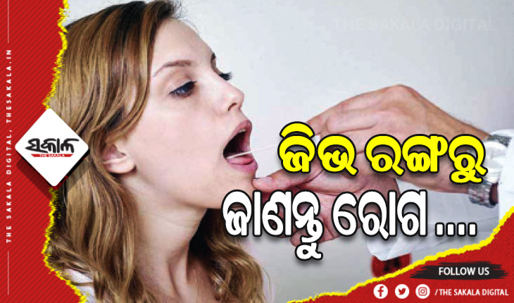 ଜାଣନ୍ତୁ କେଉଁ ରଙ୍ଗର ଜିଭ କେଉଁ ରୋଗ ସମ୍ପର୍କରେ ସୂଚନା ଦିଏ….