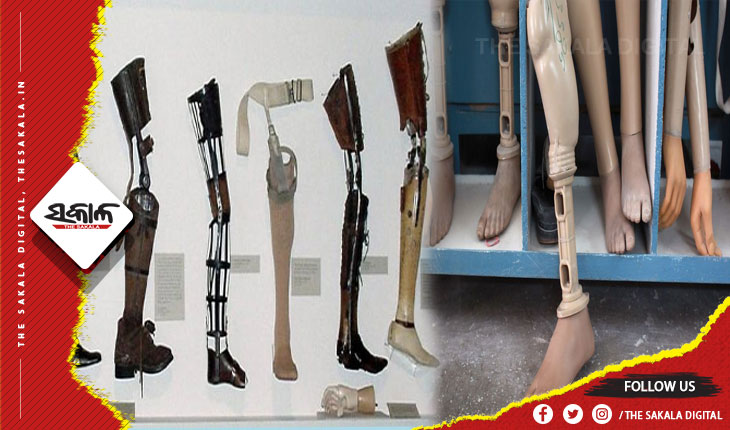 ଖୁବ ଶୀଘ୍ର ରାଜ୍ୟର ସମସ୍ତ ଜିଲ୍ଲାରେ ମିଳିବ କୃତ୍ରିମ ଅଙ୍ଗ ପ୍ରତିରୋପଣ ସୁବିଧା