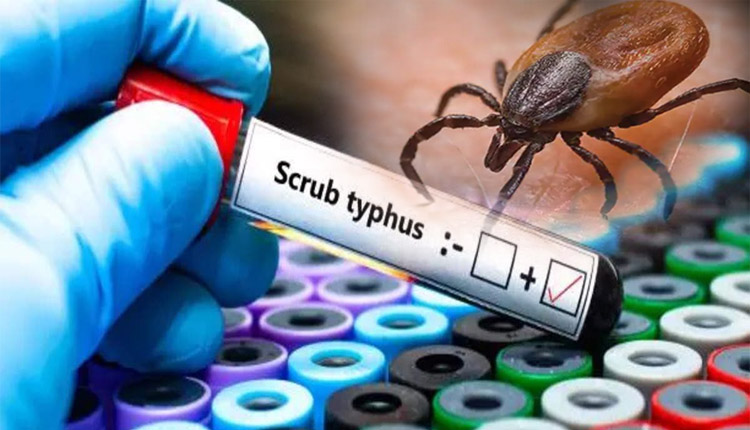 ସୁନ୍ଦରଗଡ଼ରେ ପୁଣି ୧୪ ନୂଆ ସ୍କ୍ରବ୍ ଟାଇଫସ୍‌ ରୋଗୀ ଚିହ୍ନଟ, ଆକ୍ରାନ୍ତଙ୍କ ସଂଖ୍ୟା ୨୪୪କୁ ବୃଦ୍ଧି