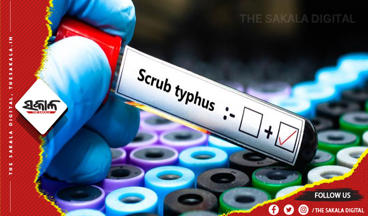 ସ୍କ୍ରବ ଟାଇଫସରେ ମୃତ୍ୟୁର ତଦନ୍ତ ପାଇଁ ବରଗଡ଼ ଓ ସୁନ୍ଦରଗଡ଼ ଗଲେ ଜନସ୍ୱାସ୍ଥ୍ୟ ବିଭାଗର ସ୍ୱତନ୍ତ୍ର ଟିମ୍