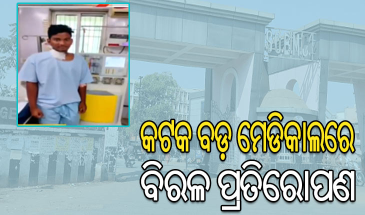 କଟକ ଏସସିବି ମେଡିକାଲରେ ସଫଳ ହେଲା ବିରଳ ହାପଲୋ ଅସ୍ଥିମଜ୍ଜା ପ୍ରତିରୋପଣ