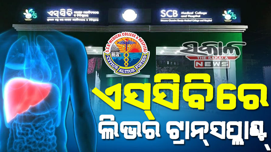 ରାଜ୍ୟ ସ୍ୱାସ୍ଥ୍ୟ ସେବା ଜଗତରେ ନୂଆ ଇତିହାସ : ଏସ୍‌ସିବିରେ ପ୍ରଥମ ଲିଭର ଟ୍ରାନ୍‌ସପ୍ଲାଣ୍ଟ୍‌