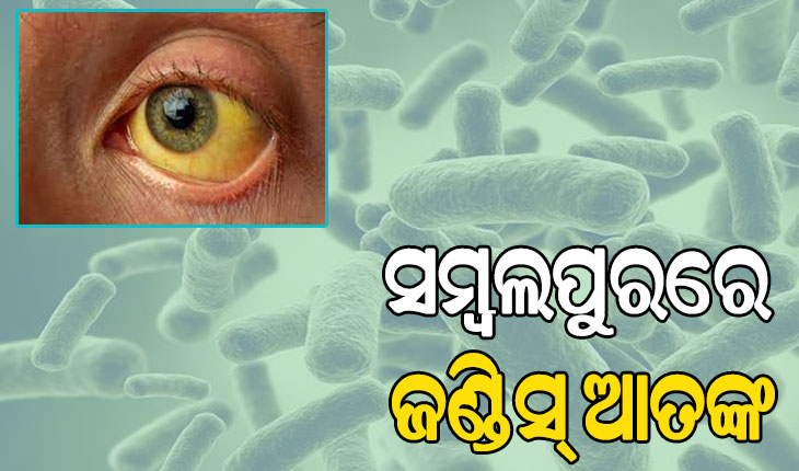 ସମ୍ବଲପୁରରେ ଜଣ୍ଡିସ୍ ଆତଙ୍କ, ଆଉ ୧୯ ନୂଆ ଆକ୍ରାନ୍ତ ଚିହ୍ନଟ