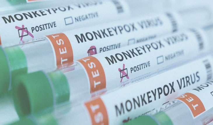 ଚିନ୍ତା ବଢ଼ାଇଲା ମଙ୍କି ପକ୍ସ: ହସ୍ପିଟାଲ ଓ ଏୟାରପୋର୍ଟକୁ ଆଲର୍ଟ ଜାରି