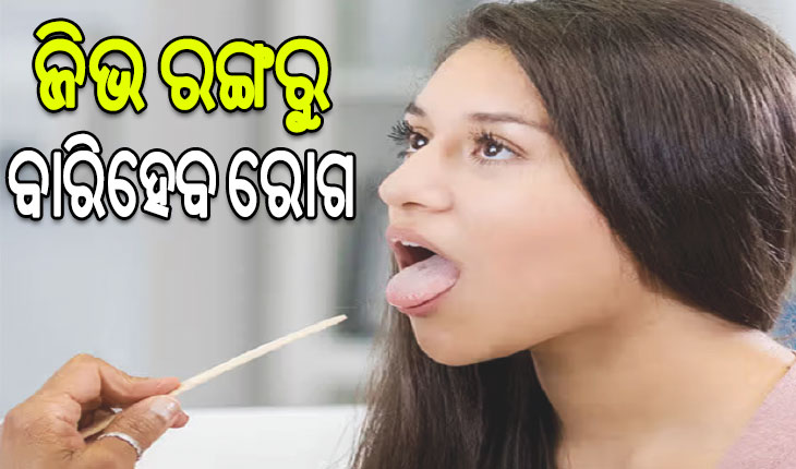 ଜିଭ ରଙ୍ଗରୁ ବାରିହେବ ରୋଗ…