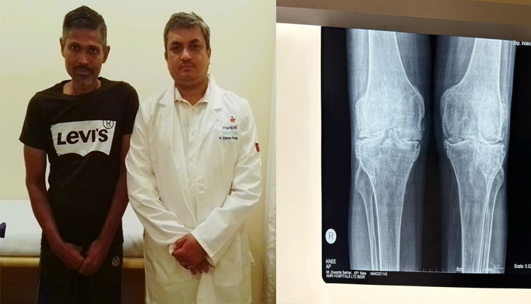 ମଣିପାଲ ହସ୍ପିଟାଲ ଭୁବନେଶ୍ୱରରେ ଅସ୍ଥିଶଲ୍ୟ ବିଭାଗର ସଫଳତା: ୨୨ ବର୍ଷ ଧରି ଶୋଇ ରହୁଥିବା ଯୁବକ ପୁଣି ଥରେ ଚାଲିଲେ