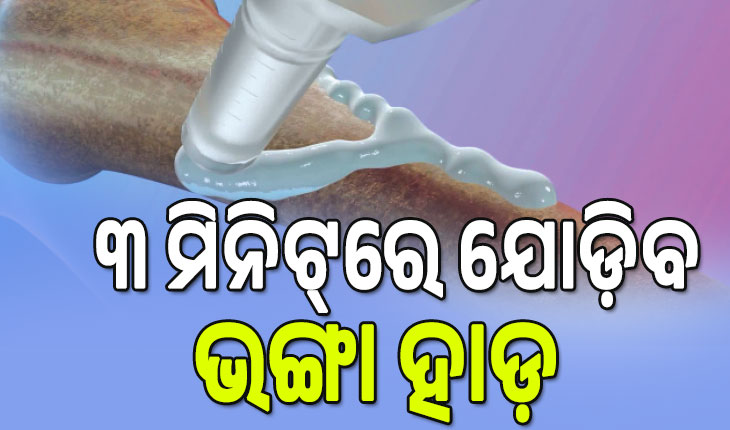 ୩ ମିନିଟ୍‌ରେ ଭଙ୍ଗା ହାଡ଼ ଯୋଡ଼ିବ ‘ବୋନ୍‌ ଗ୍ଲୁ’